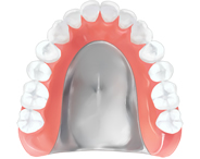金属床義歯 (総義歯)